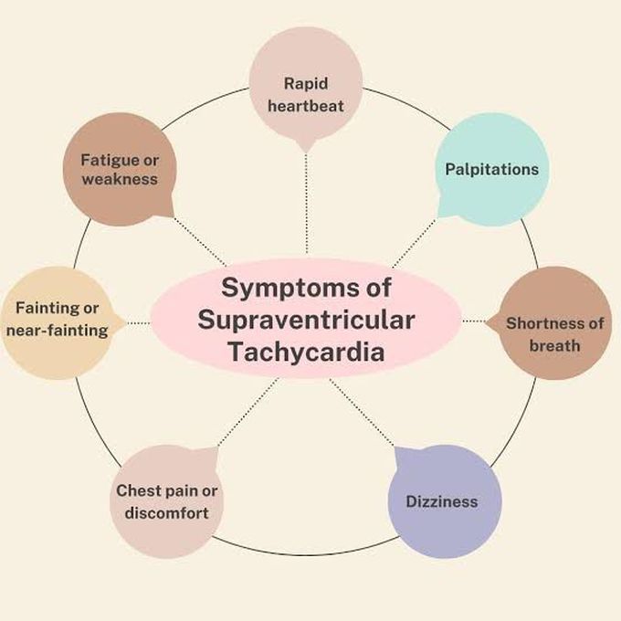 Supraventricular tachycardia- Symptoms