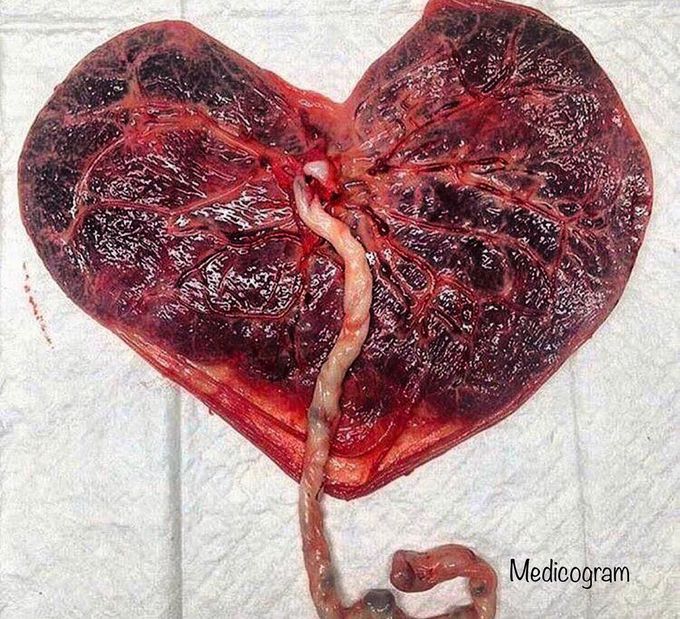 Placenta