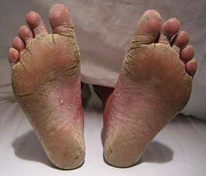What is diagnosis this condition?