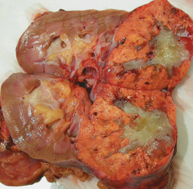 KIDNEY