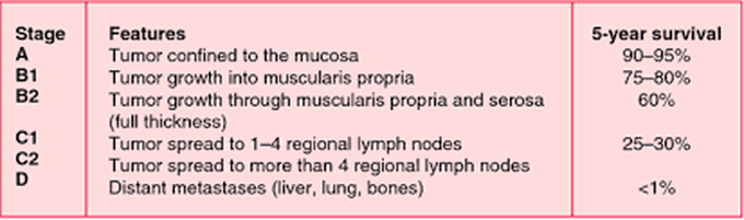 Dukes cancer staging