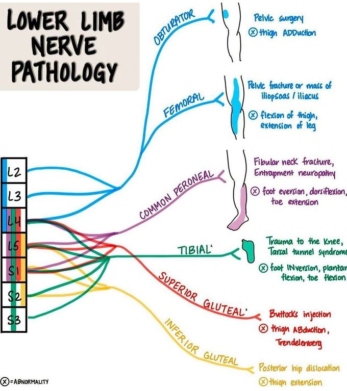 Lower Limb Nerve Pathology