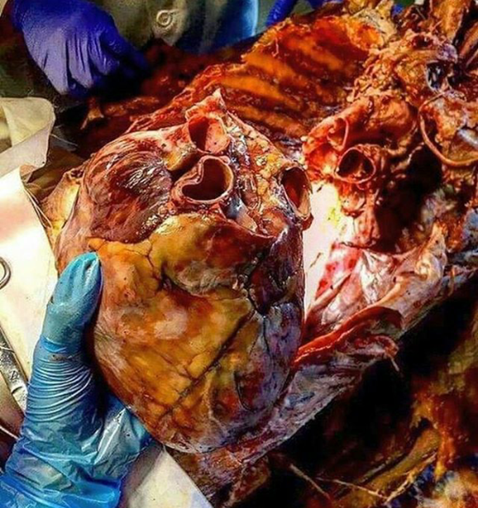 Smoking is bad for Health.. ❌