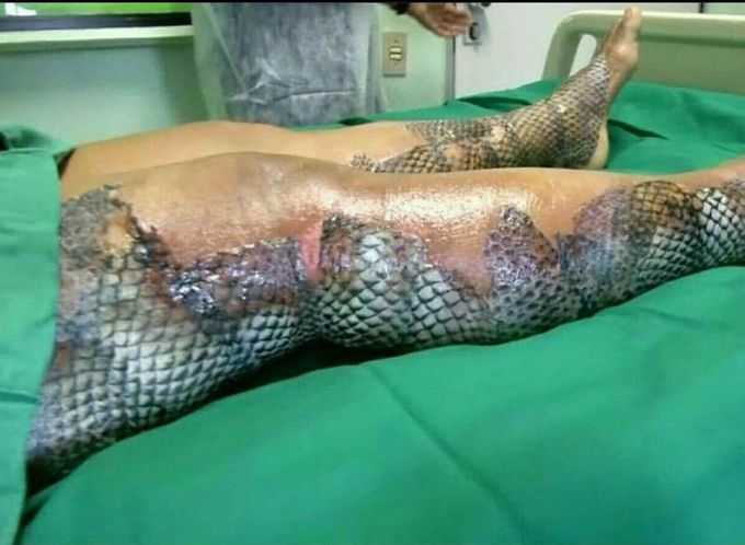 Fish skin