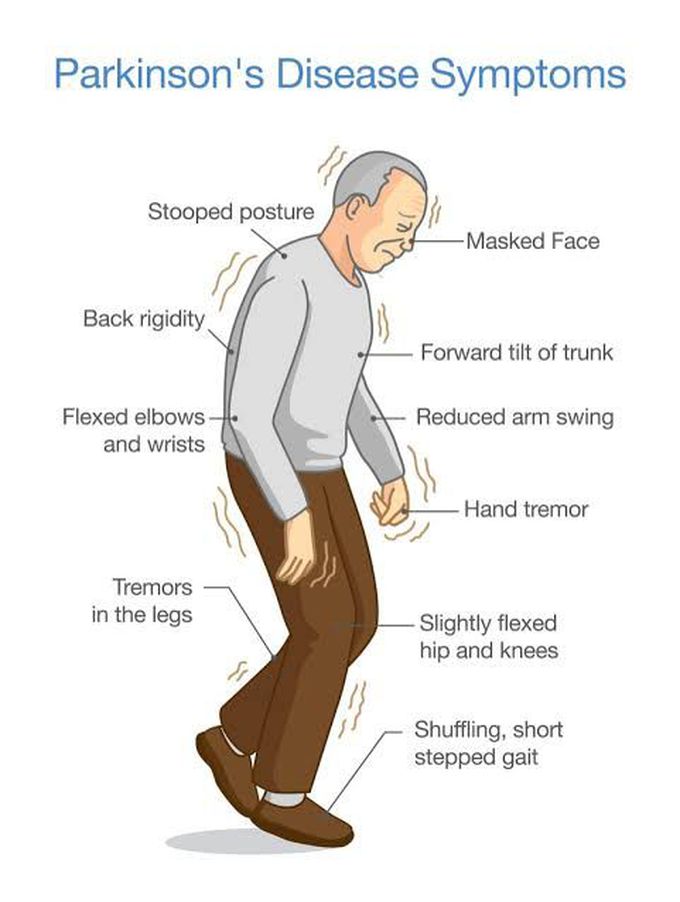 Symptoms of parkinsons