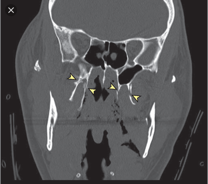 Diagnosis?