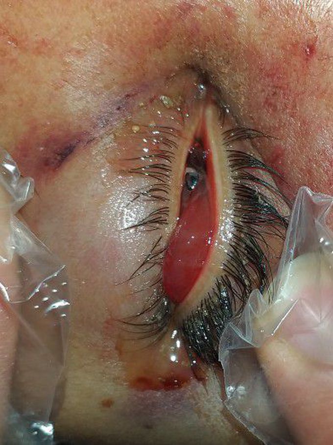 What is your diagnosis?