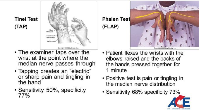 Test of carpal tunnel syndrome