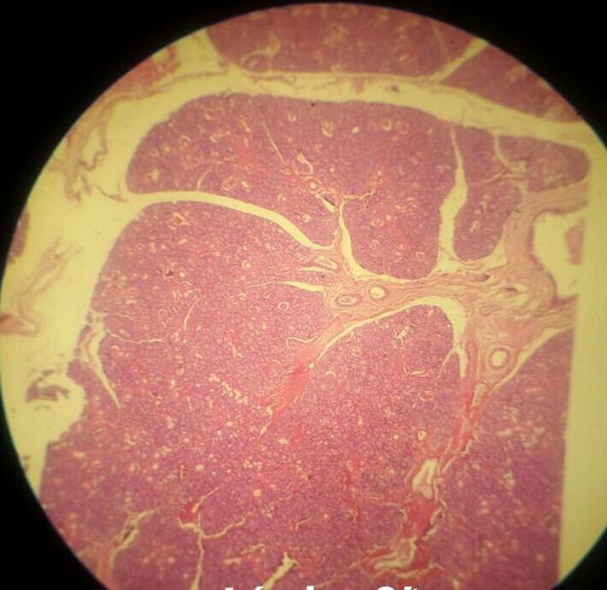 Glandula Submandibulr