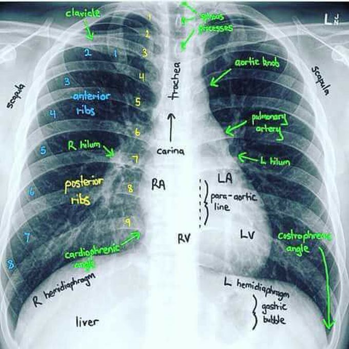 X Ray determination - MEDizzy