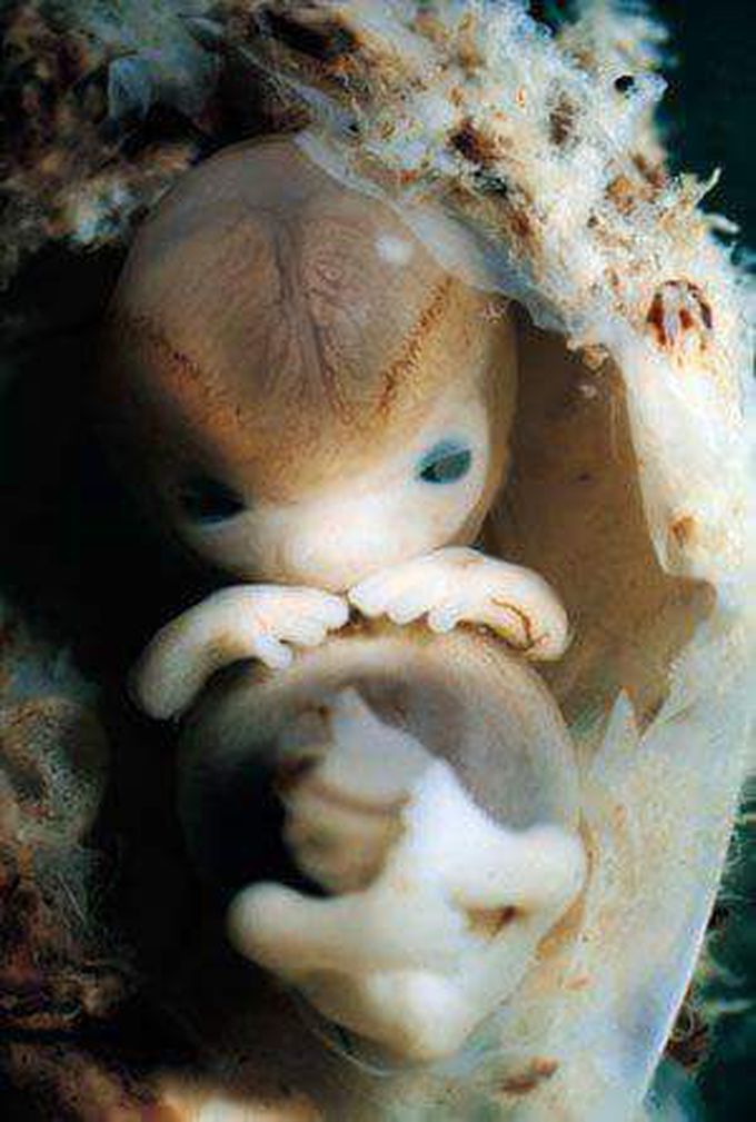 Fetus.....