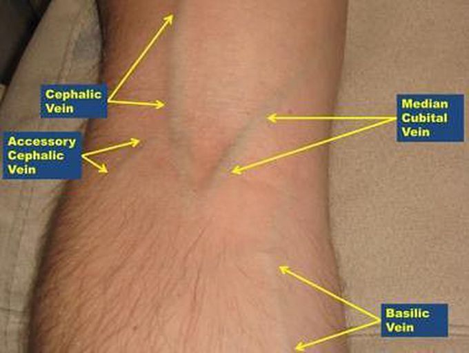 Labeled arm showing the antecubital veins 