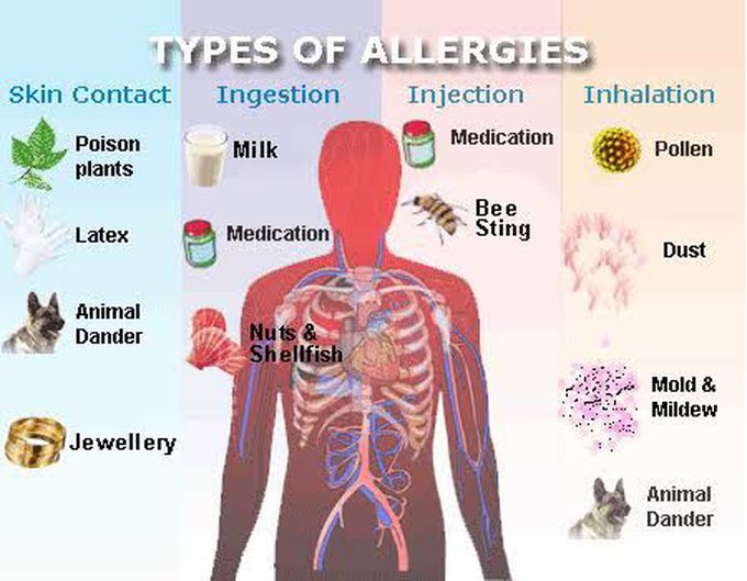 Types of allergies