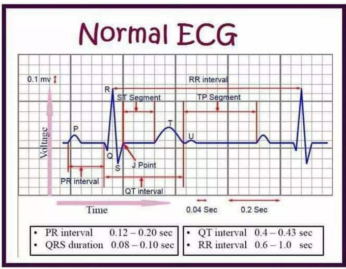 Normal ECG