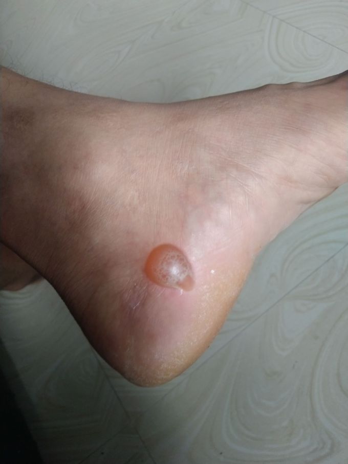 Diagnosis this....