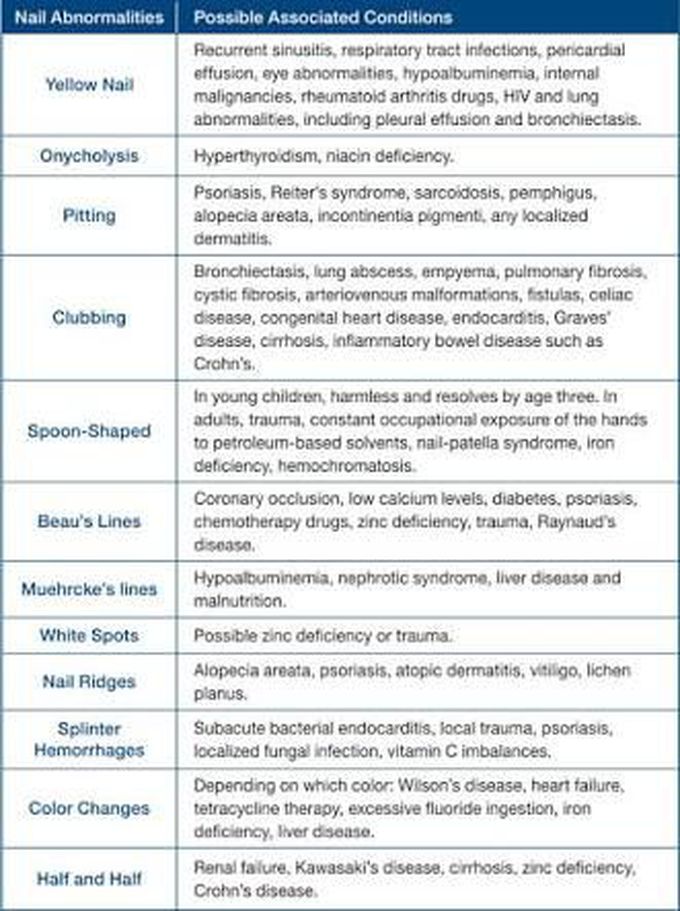 Nail abnormalities