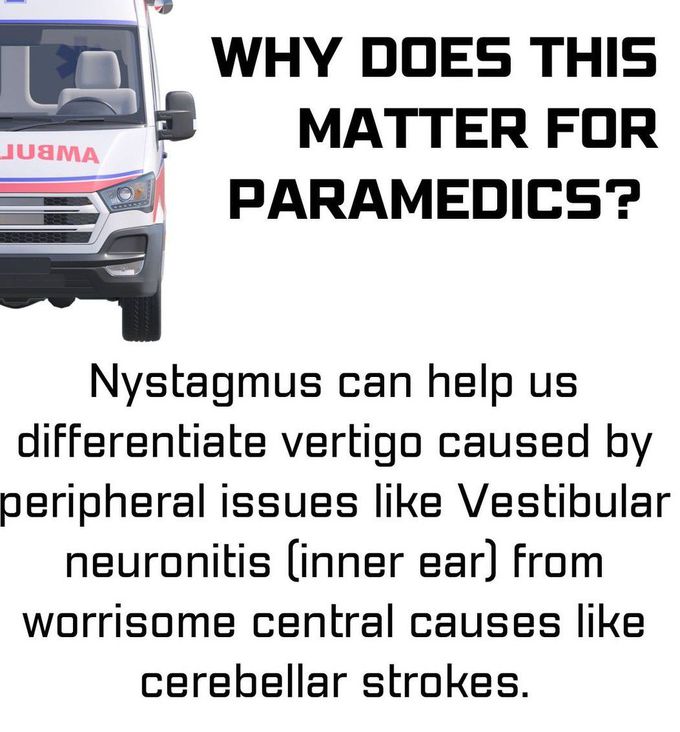 Nystagmus III