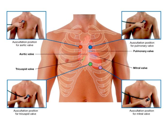 Aortic valve-tricuspid valve-bicuspid valve