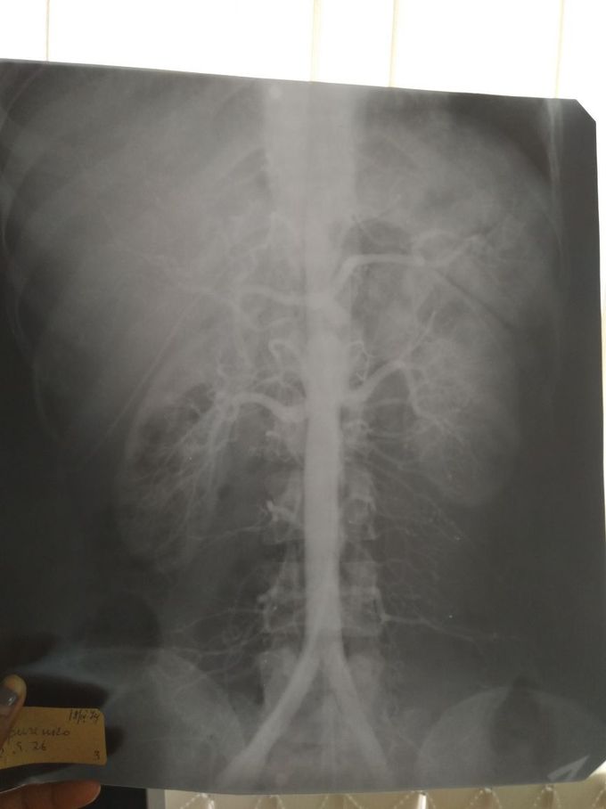 Please diagnose