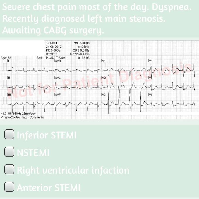 EKG..