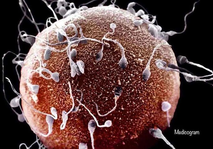 An Ovum (Egg cell) Surrounded by Sperm