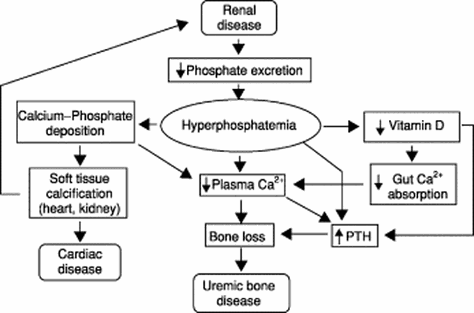 Hyperphosphatemia - MEDizzy