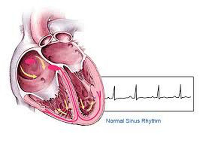 Treatment for atrial fibrillation