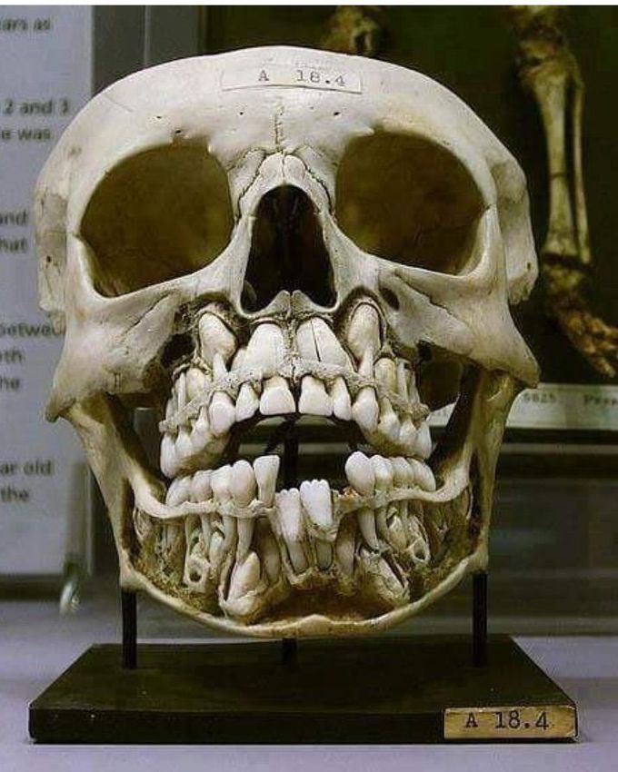 anatomia💀😍 Image of a child's skull still with milk teeth. The Hunter Museum of the university of Glasgow has on display a skull of a child where it is possible to observe the deciduous teeth (milk teeth) and the permanent one to come.