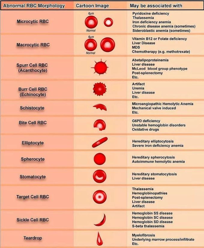 Abnormalities in RBCs