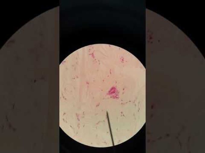 Dense Irregular Connective Tissue Histology