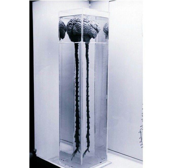 An adult spinal cord and brain preserved.