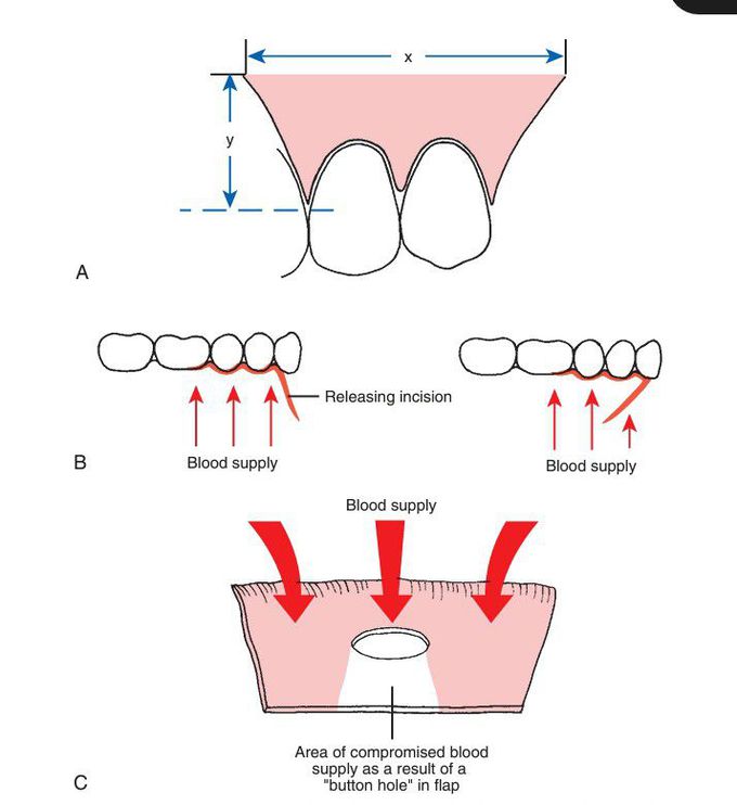 Principles of flap design