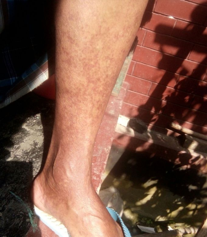 what would be the diagnosis?