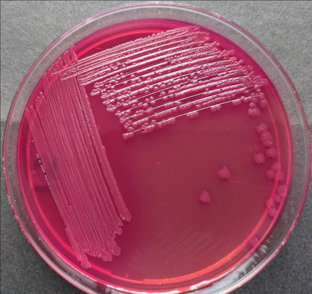 Escherichia Coli MEDizzy