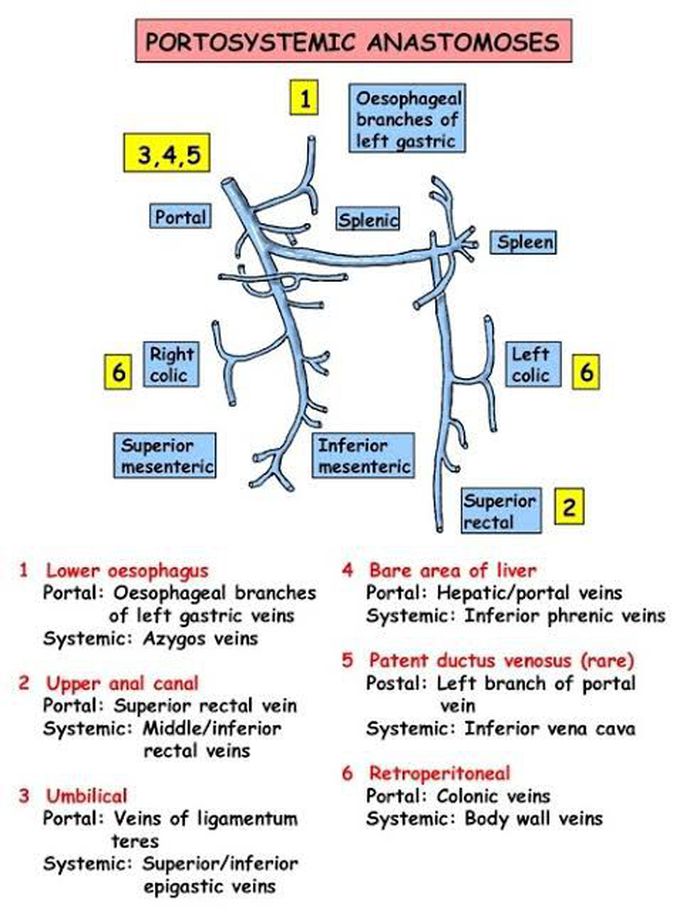 Portosystemic Anastomosis