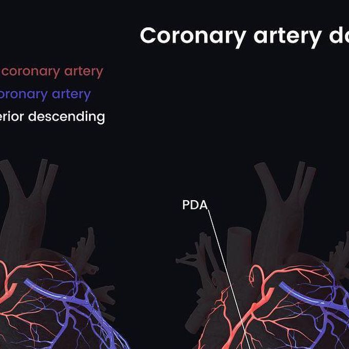 Coronary artery dominance