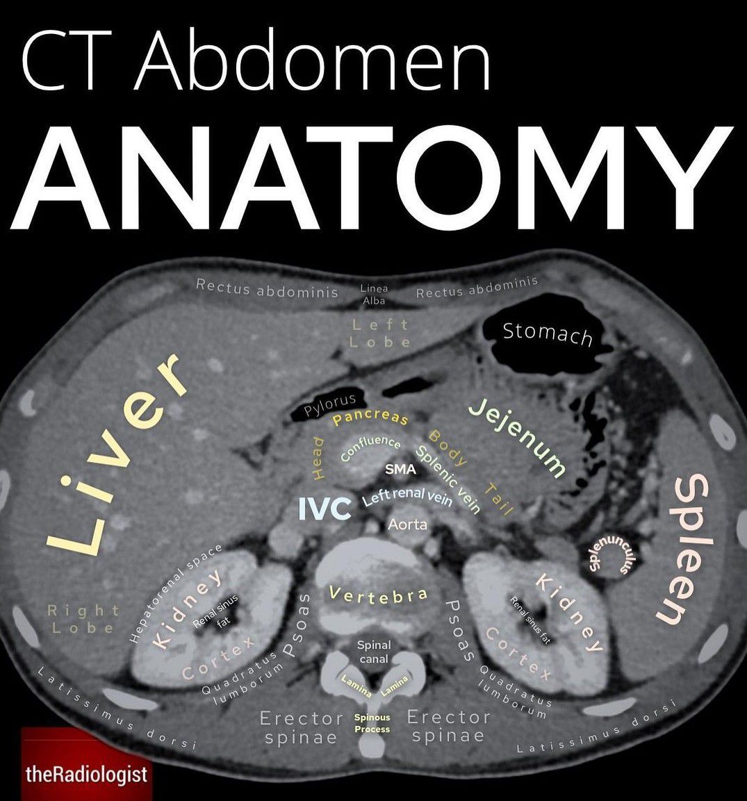 Ct Scan Abdomen Anatomy Cross Sectional Anatomy Of The Abdomen
