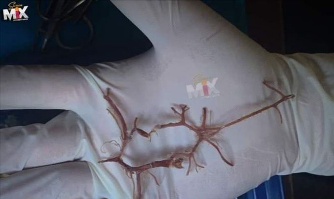 Circle of Willis