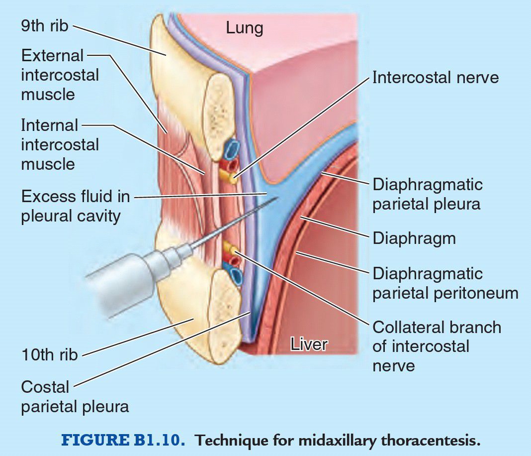 How Is Your ECG Electrode Placement? – The Student Physiologist, image size:1068x916