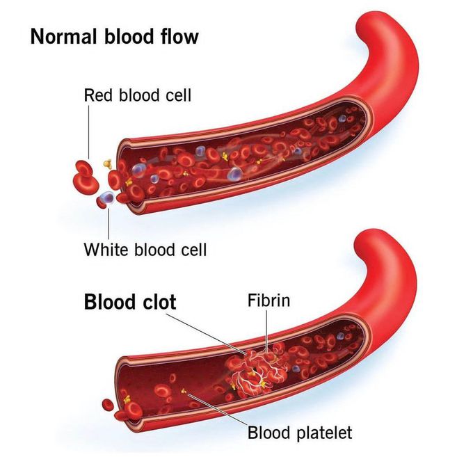 Blood Flow