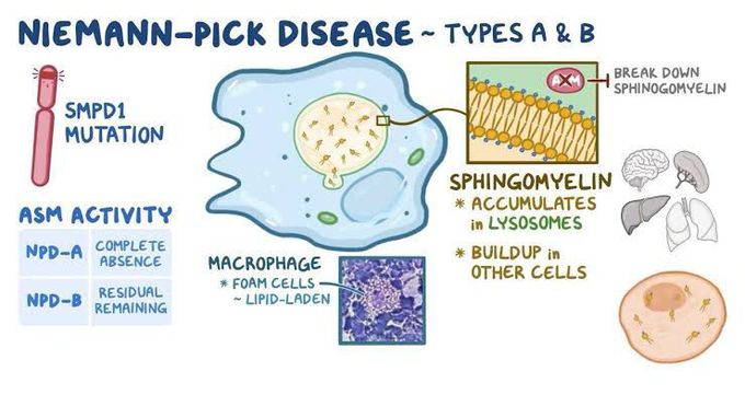 Cause of neimann pick disease