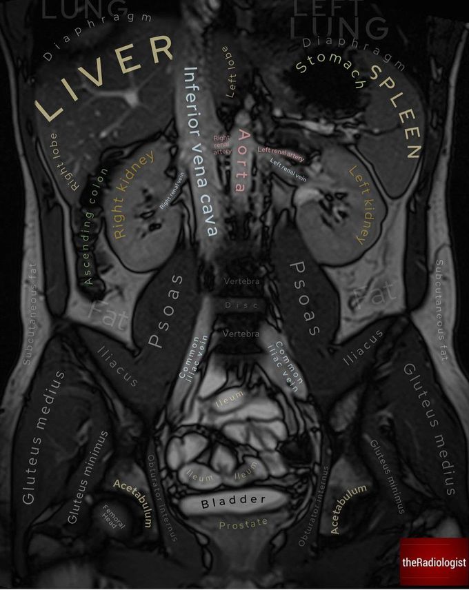 Coronal Abdominal Radiology