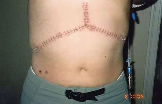 Name this scar for what use for????