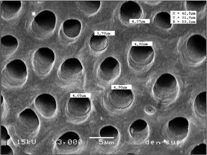 Dentinal tubules