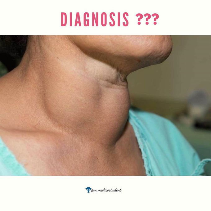 Diagnose it ?