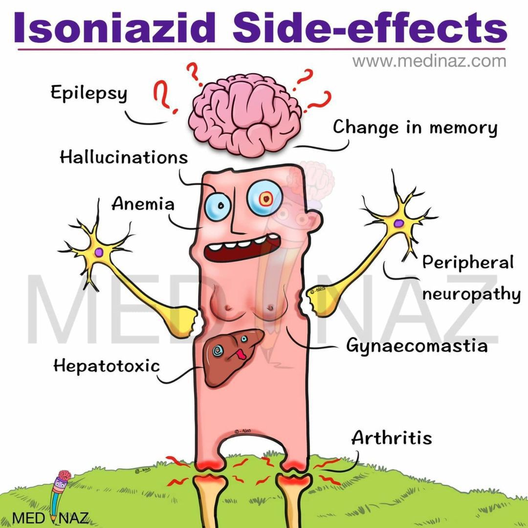 Side effects isoniazid Isoniazid vs