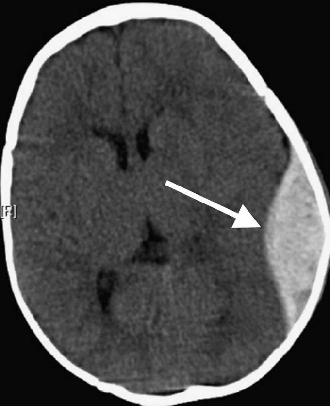 What is your due diagnostics