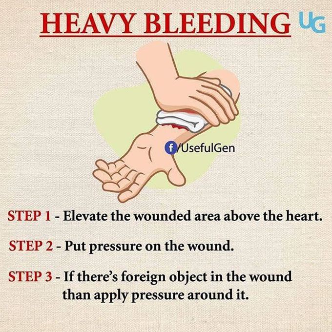 Heavy bleeding management