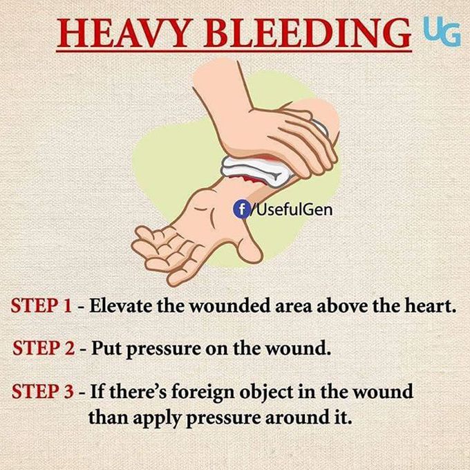 What Is The Best Treatment For Heavy Bleeding