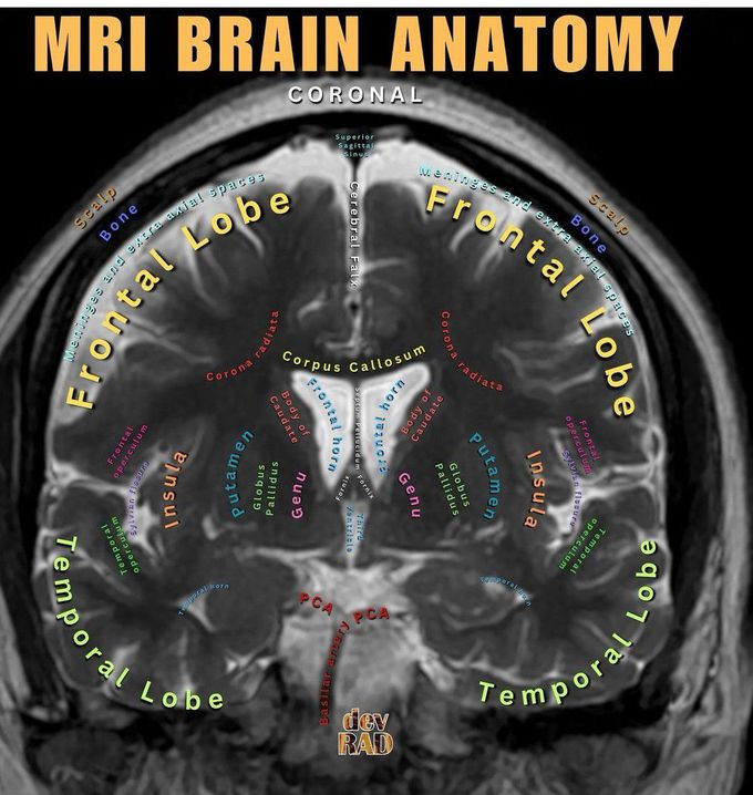 MRI Brain Anatomy